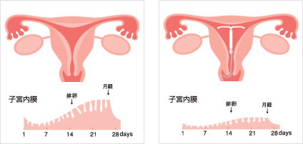 子宮内膜の変化（イメージ）